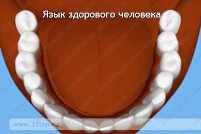 Язык здорового человека Язык здорового человека