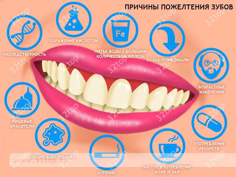 Причины пожелтения зубов