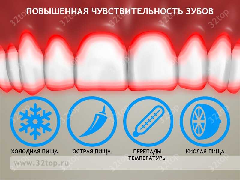 Температура после лечения зуба. Чувствительность зубов. Повышенной чувствительности зубов. Повышенная чувствительность зуба.