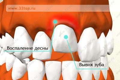 Травматические повреждения челюстно-лицевой области - презентация онлайн