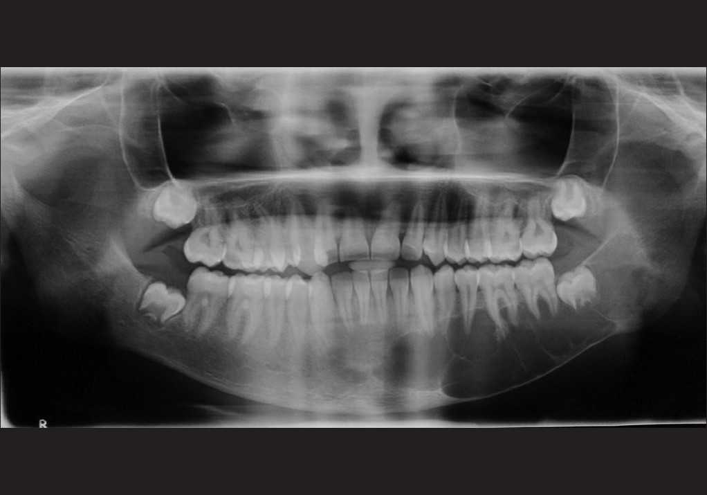 Киста Нижней Губы Фото – Telegraph