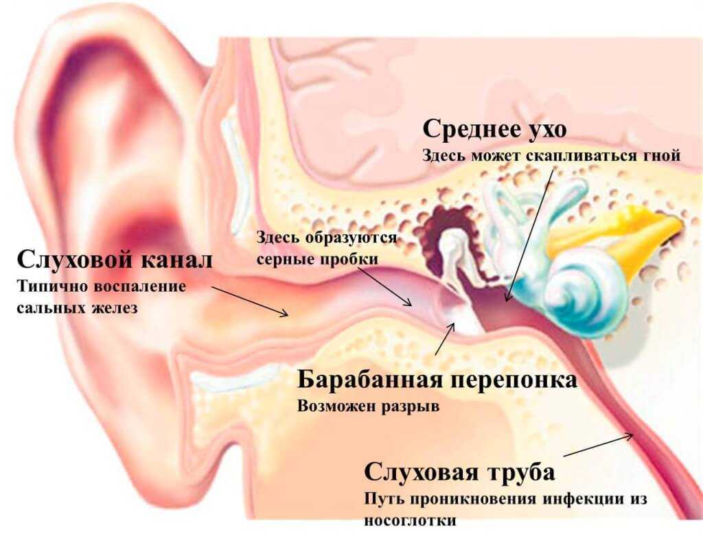 Перфорация дна гайморовой пазухи