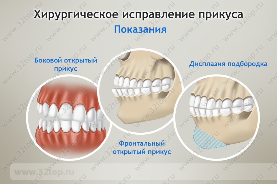 Правильный прикус у человека схема как определить фото