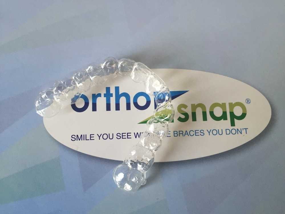 Biomim металлические лигатурные. ). Бонд ортосоло orthosolo 5мл. Адгезив для фиксации брекетов ормко. Ortho talks.