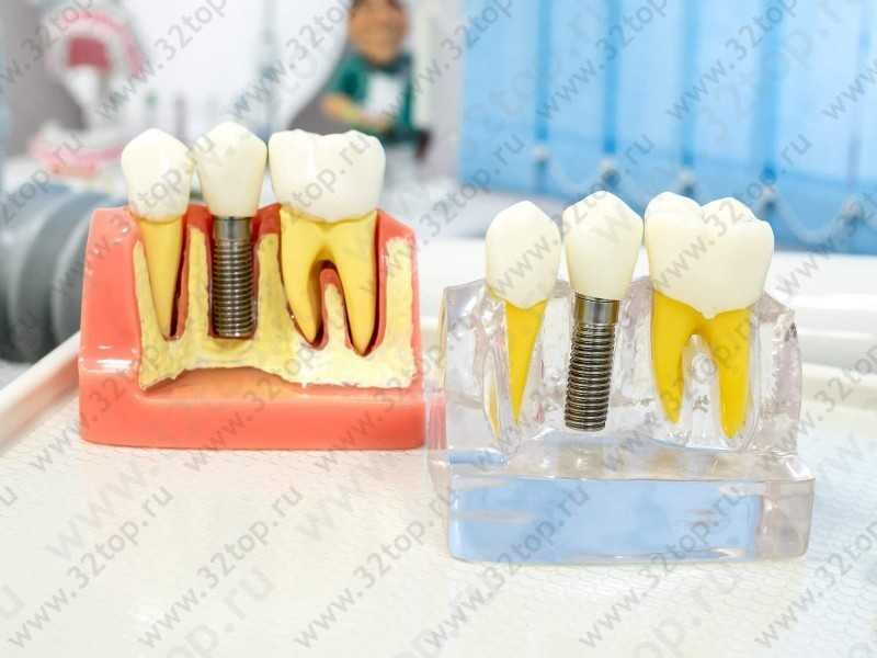 Европейская стоматологическая практика НОВАDЕНТ (НОВАДЕНТ) м. Верхние Лихоборы