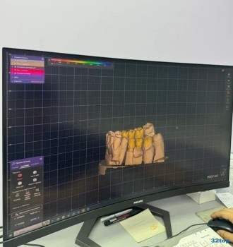 Стоматология ДЕНТТАЙМ на Кирова