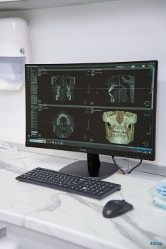 Эстетическая стоматология и имплантология IMPLANT DENTISTRY (ИМПЛАНТ ДЕНТИСТРИ) на Сормовской