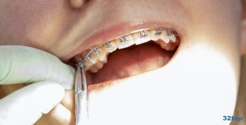 Стоматология САВИОН м. Площадь Ленина