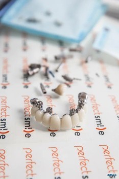 Центр эстетической стоматологии и костной регенерации ПЕРФЕКТСМАЙЛ (PERFECTSMILE) м. Чернышевская