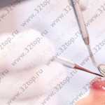 Стоматология LUXNEERS (ЛЮКСНИРС) м. Чеховская