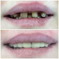 Стоматология ВЕАДЕНТ