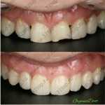 Стоматологическая клиника ORGANIC DENT (ОРГАНИК ДЕНТ) м. Тульская