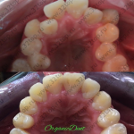 Стоматологическая клиника ORGANIC DENT (ОРГАНИК ДЕНТ) м. Тульская