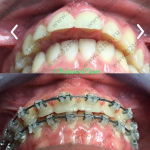Стоматологическая клиника ORGANIC DENT (ОРГАНИК ДЕНТ) м. Тульская