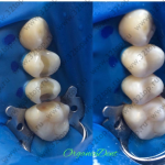 Стоматологическая клиника ORGANIC DENT (ОРГАНИК ДЕНТ) м. Тульская