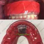 Стоматологическая клиника ORGANIC DENT (ОРГАНИК ДЕНТ) м. Тульская