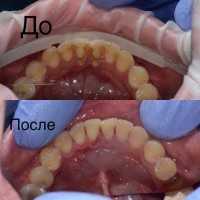 Стоматология ДЕЛЬТА-ДЕНТ