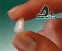 Стоматология ДЕЛЬТА-ДЕНТ