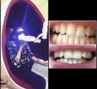 Салон косметического отбеливания зубов WHITE & SMILE