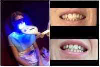 Салон косметического отбеливания зубов WHITE & SMILE