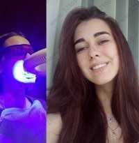 Салон косметического отбеливания зубов WHITE & SMILE