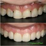 Стоматологическая клиника ORGANIC DENT (ОРГАНИК ДЕНТ) м. Тульская