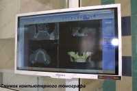 Медико-стоматологический центр НОВАЦИЯ на Васильева