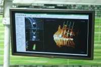 ЦЕНТР ИМПЛАНТАЦИИ