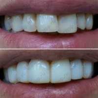 Стоматология СМАЙЛ ЛАКШРИ