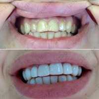 Стоматология СМАЙЛ ЛАКШРИ