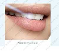 Клиника лазерной стоматологии профессора Рисованной О. Н. АКАДЕМИЯ ЛАЗЕРА