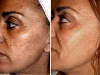 Медицинский центр ИН-КЛИНИК м. Отрадное