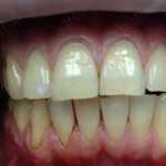 Недорогая стоматология ЛИГАДЕНТ м. Ростокино