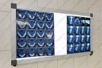 Стоматология АРБАЛЬ м. Бульвар Дмитрия Донского