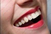 Стоматология 33-Й ЗУБ м. Проспект Просвещения