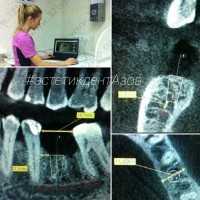 Стоматологический центр ЭСТЕТИК-ДЕНТ