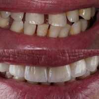 Стоматология ДАНТИСТ на Верхних Полях