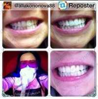 Салон косметического осветления зубов PEARLSMILE