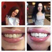 Салон косметического осветления зубов PEARLSMILE