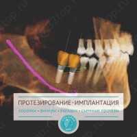 Стоматологическая клиника АПОЛЛОНИЯ ДЕНТ на Александра Матросова