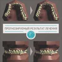 Стоматологическая клиника АПОЛЛОНИЯ ДЕНТ на Александра Матросова