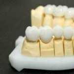 СТОМАТОЛОГИЯ БЕЗ БОЛИ