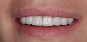 Стоматология DENTCLINIC (ДЕНТКЛИНИК) м. Алабинская