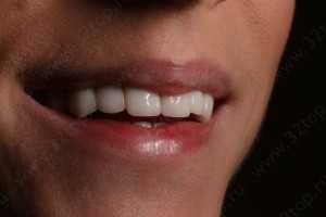 Стоматология DENTCLINIC (ДЕНТКЛИНИК) м. Алабинская