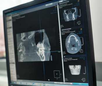 Семейная стоматология ВАРИАНТ м. Алабинская