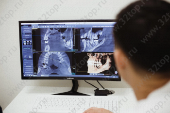Стоматологическая клиника SAFE DENTAL CLINIC (СЭЙФ ДЕНТАЛ КЛИНИК) м. Крылатское