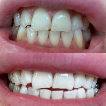 Студия по отбеливанию зубов УАЙТ ЭНД СМАЙЛ (WHITE&SMILE)