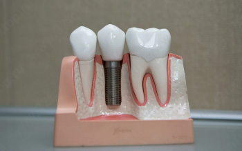 СТОМАТОЛОГИЯ ДОКТОРА КОСНЕВИЧА