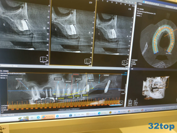 Стоматология ЗУБЫ ЗА ОДИН ДЕНЬ