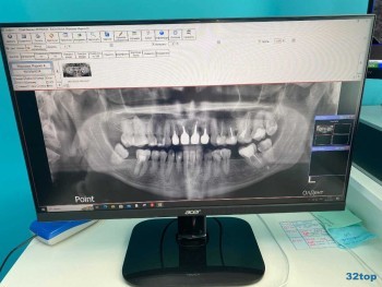 Стоматологическая клиника ОЛДЕНТ м. Преображенская площадь